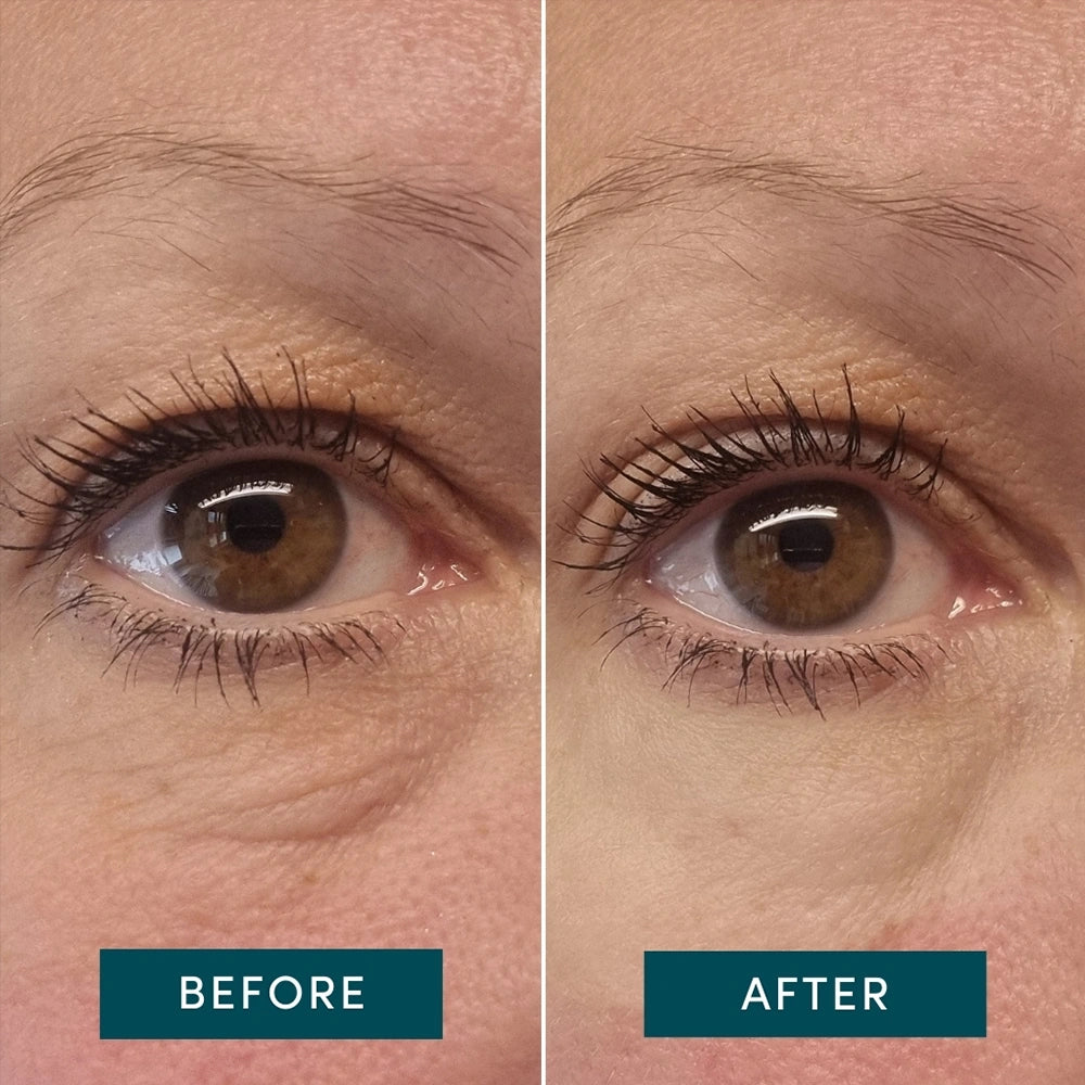 Voor en na van de Apricot Eye Pads. Gebruik de pad elke nacht voor het beste resultaat. Je kan de silicone pad gemakkelijk reinigen en tot wel 30 keer hergebruiken en zijn geheel vegan en dierproefvrij. Bevat 2 herbruikbare siliconen pads.