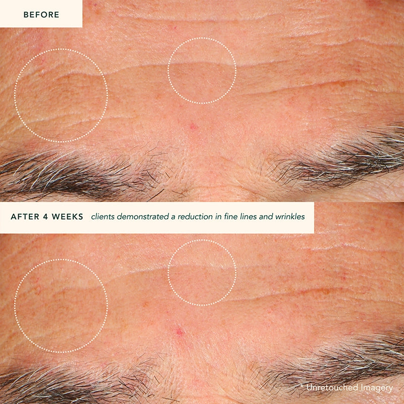 Ranavat Restoring Moonseed Treatment is een innovatieve herstelbehandeling voor de huid, die klinisch bewezen is om fijne lijntjes te verminderen en roodheid en irritatie te verzachten. Het is een balsem die geschikt is voor normale, droge en gecombineerde huidtypes die echt heelijk ruikt! Deze vegan behandeling bevat een blend van meer dan 30 ayurvedische ingrediënten die zorgvuldig zijn geselecteerd om de huid te revitaliseren en te herstellen 