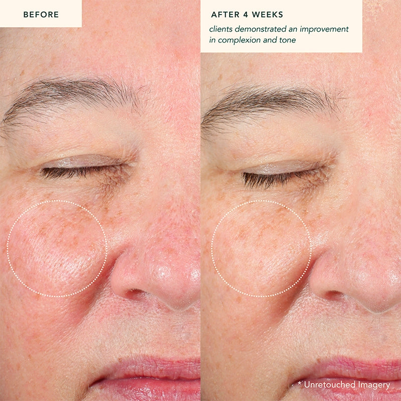 Ranavat Restoring Moonseed Treatment is een innovatieve herstelbehandeling voor de huid, die klinisch bewezen is om fijne lijntjes te verminderen en roodheid en irritatie te verzachten. Het is een balsem die geschikt is voor normale, droge en gecombineerde huidtypes die echt heelijk ruikt! Deze vegan behandeling bevat een blend van meer dan 30 ayurvedische ingrediënten die zorgvuldig zijn geselecteerd om de huid te revitaliseren en te herstellen 